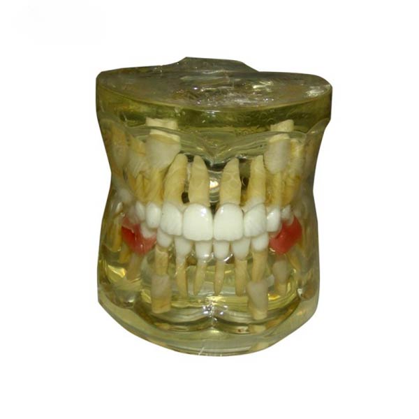 一次歯の早期喪失UM-7019病理学的モデル