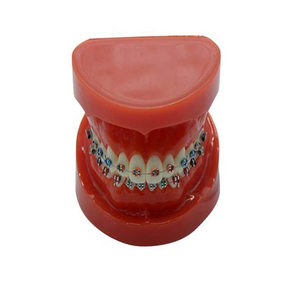 歯に固定ブレース付きUM-B16研究モデル (通常)