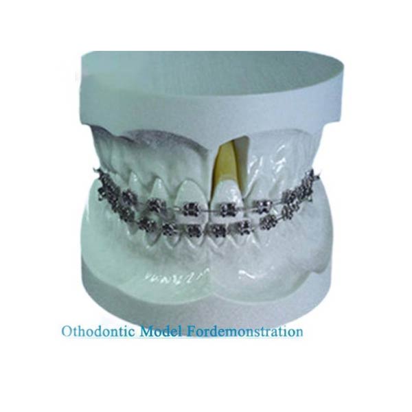 エッジワイズブラケットを使用したデモンストレーションのためのUM-S11歯科矯正モデル