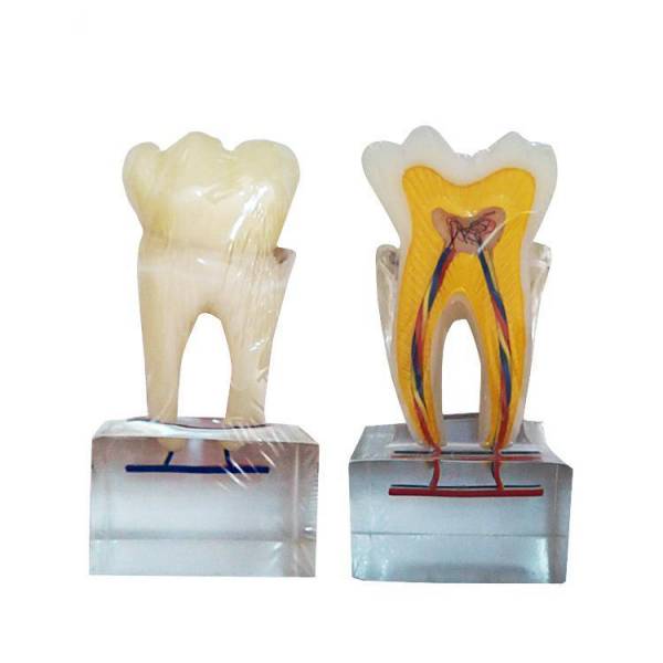 UM-U14 6倍の通常の歯の解剖学モデル