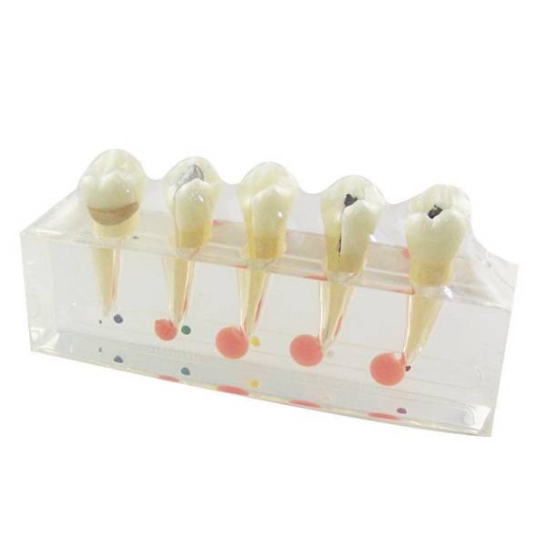 口腔外科のための合成トレーニングモデルのUM-L3