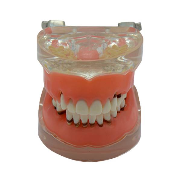 UM-S9歯肉疾患モデル