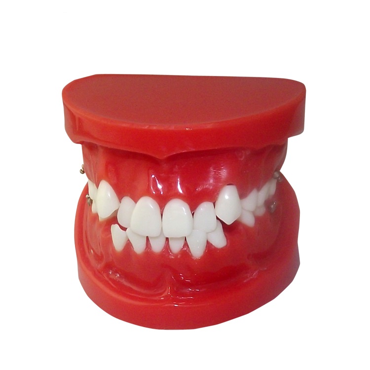 UM-B14歯科矯正モデル
